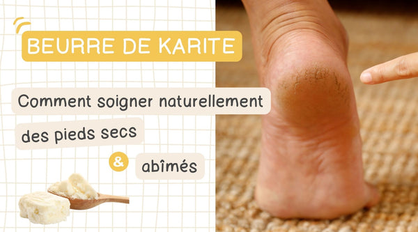 Comment soigner naturellement les pieds secs et abîmés avec du beurre de karité ?