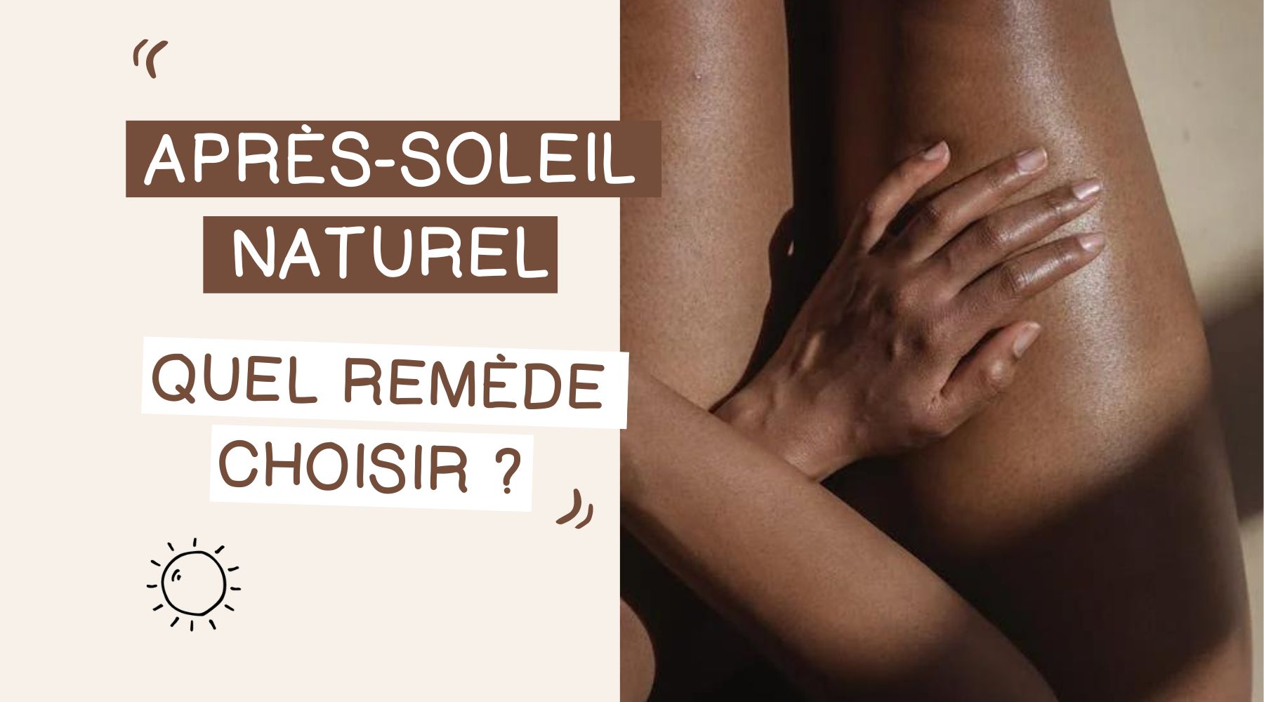 Après-soleil naturel : quel remède choisir ?