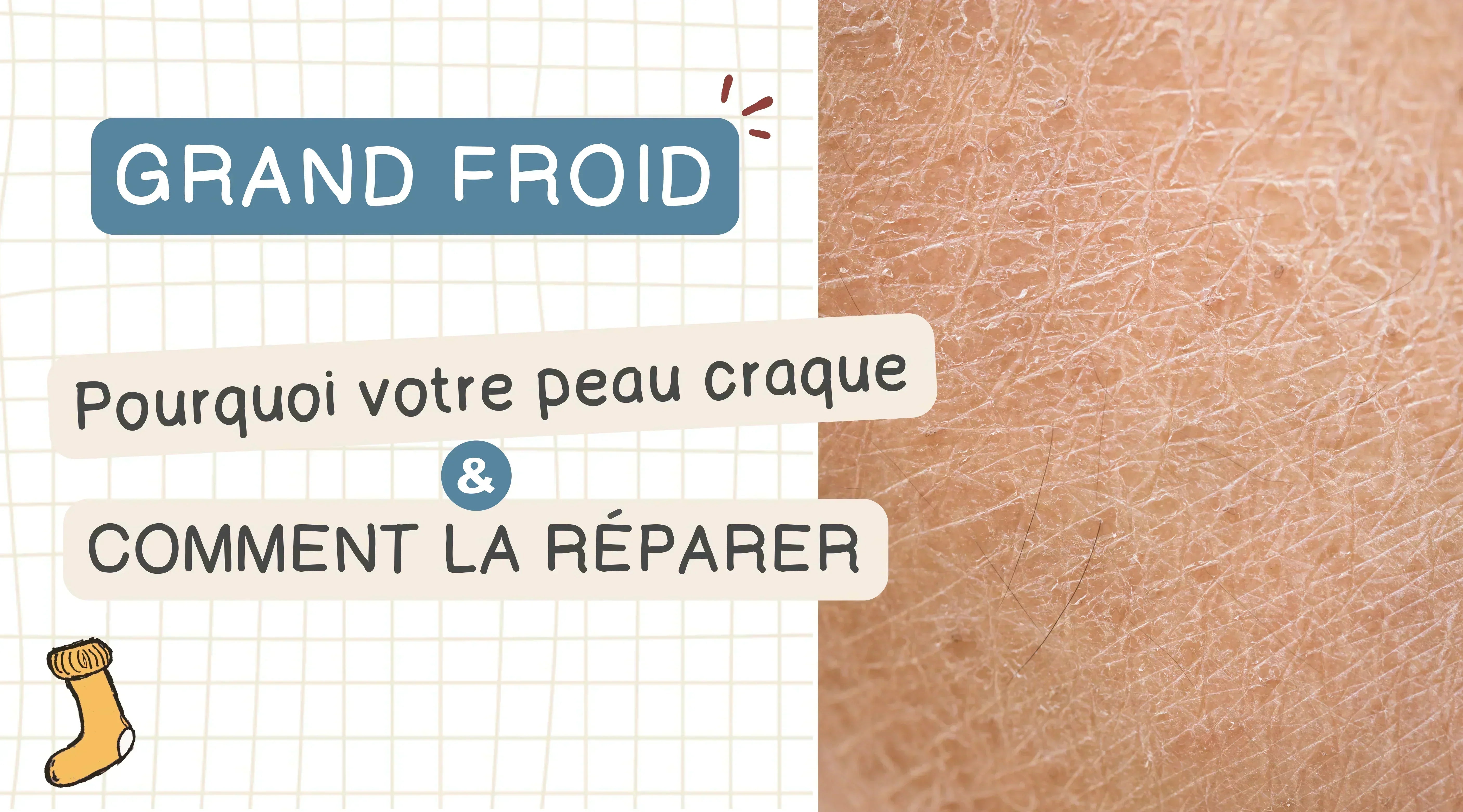 Grand froid : pourquoi votre peau craque… et comment la réparer